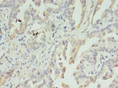 Polyclonal Rabbit anti-Human IMPDH2 Antibody (IHC, WB)