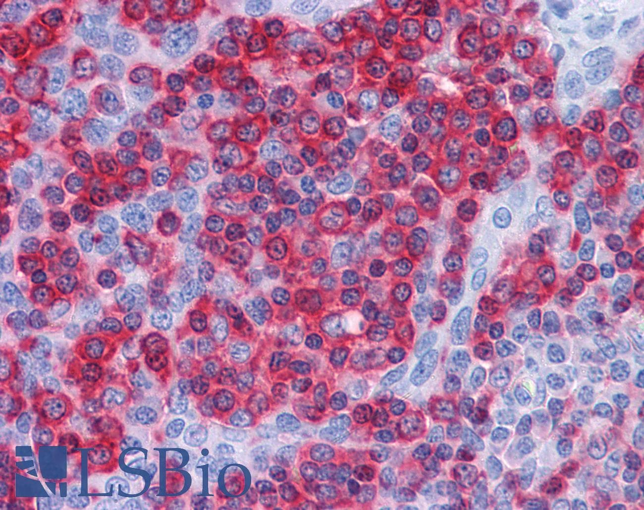 IHC-plus™ PREP / Prolyl Endopeptidase Antibody (aa657-669)