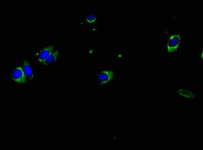 IHC-plus™ Polyclonal Rabbit anti-Human HLA-DPA1 Antibody (IHC, WB)