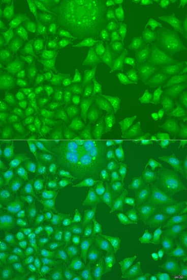 IHC-plus™ CCND2 / Cyclin D2 Antibody