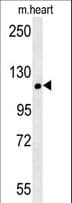 CRB2 Antibody (aa1258-1285)
