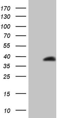 LGALS9 / Galectin 9 Antibody (clone OTI2E10)