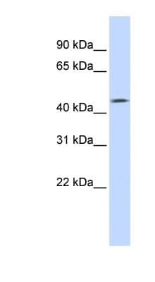 TMEFF1 / Tomoregulin 1 Antibody (aa144-193)