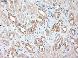 KRT19 / CK19 / Cytokeratin 19 Antibody (clone OTI5D1)