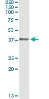 HOXD1 Antibody (clone 4F4)