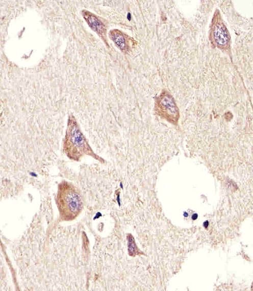 CHRM2 / M2 Antibody (clone 1424CT461.78.60)