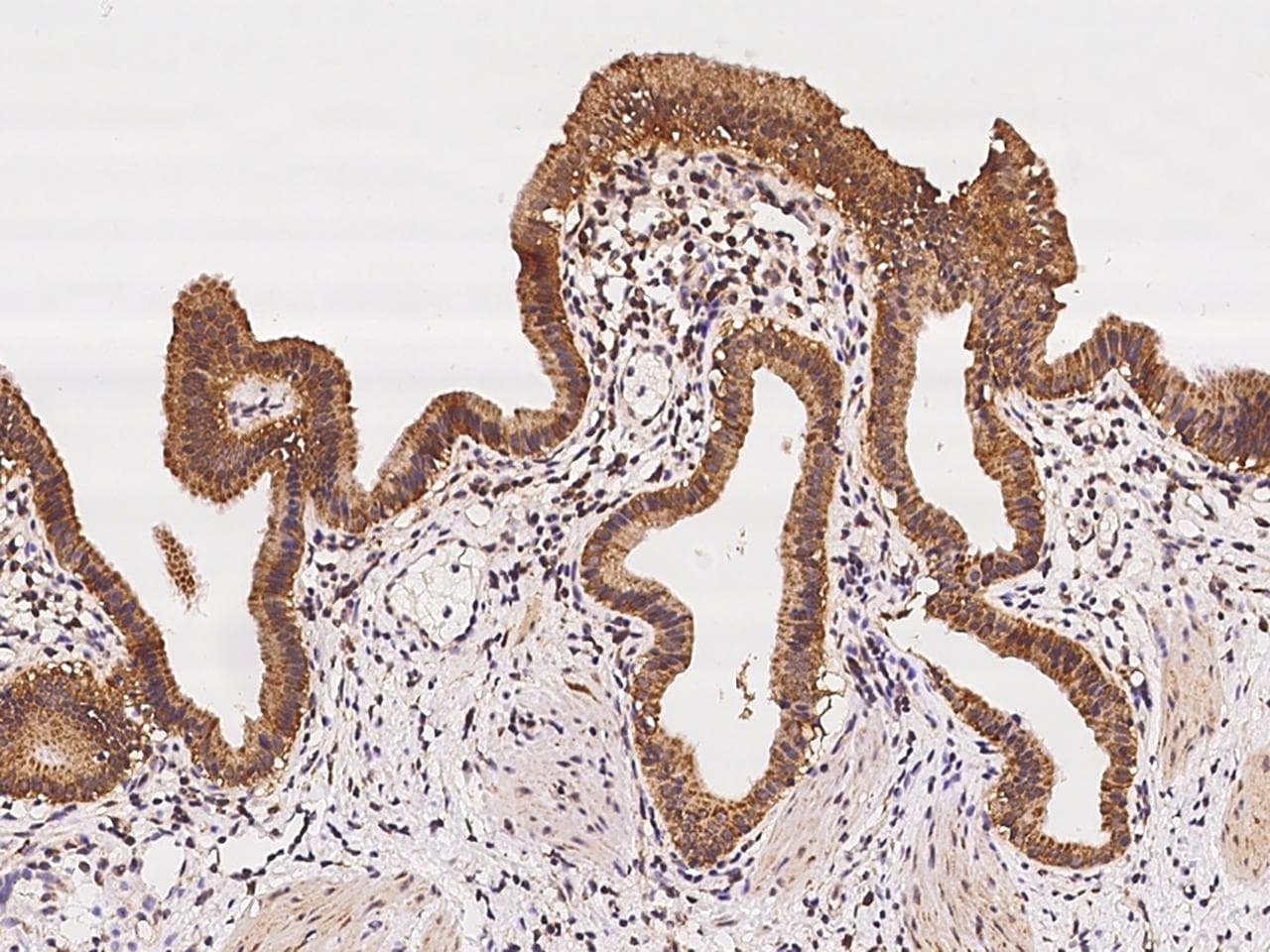 MRPS5 Antibody