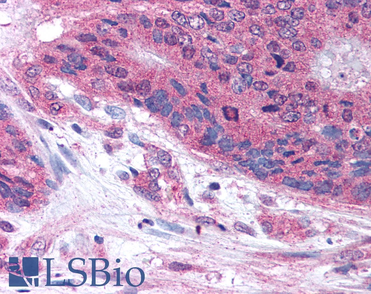 IHC-plus™ PLA2G3 Antibody (Internal)