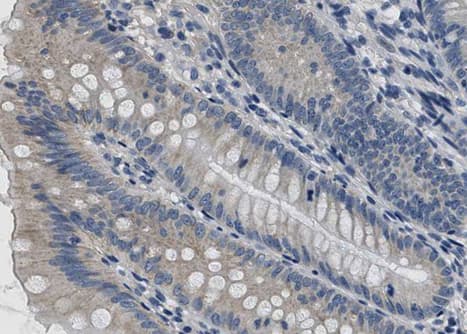 BMP2 Antibody
