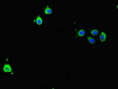 BIRC5 / Survivin Antibody