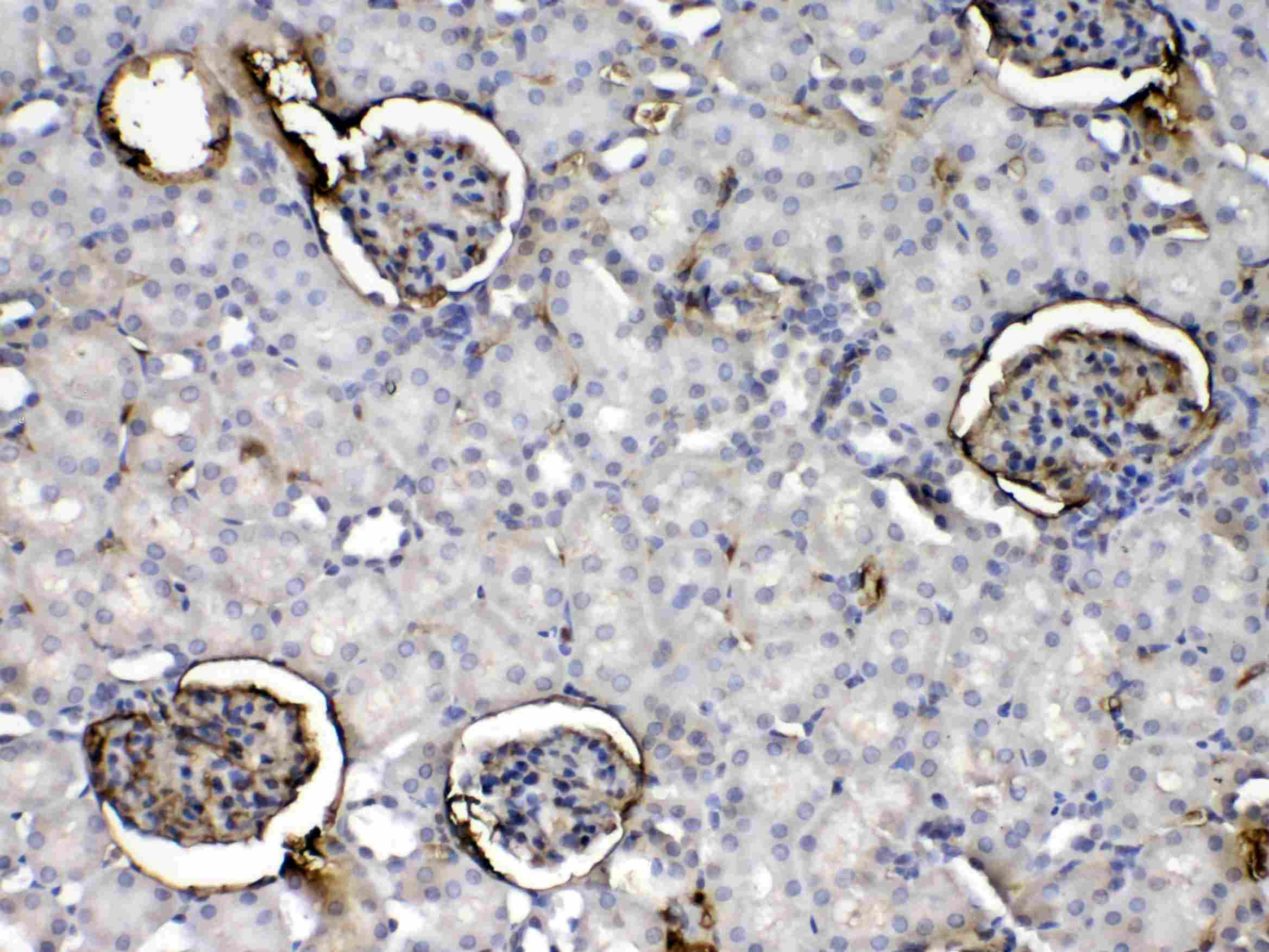 CRP / C-Reactive Protein Antibody
