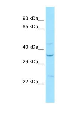 SIPR2 / S1P2 / EDG5 Antibody (N-Terminus)