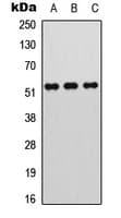 MEF2A / MEF2 Antibody (phospho-Thr312)