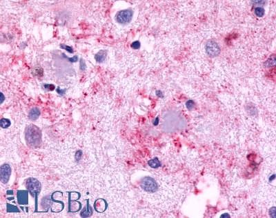 PathPlus™ CELSR3 Antibody (N-Terminus)