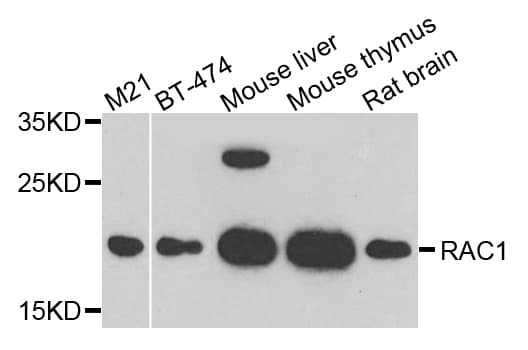RAC1 Antibody