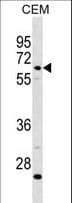 Polyclonal Rabbit anti-Human Complement C8b Antibody (aa393-422, WB)