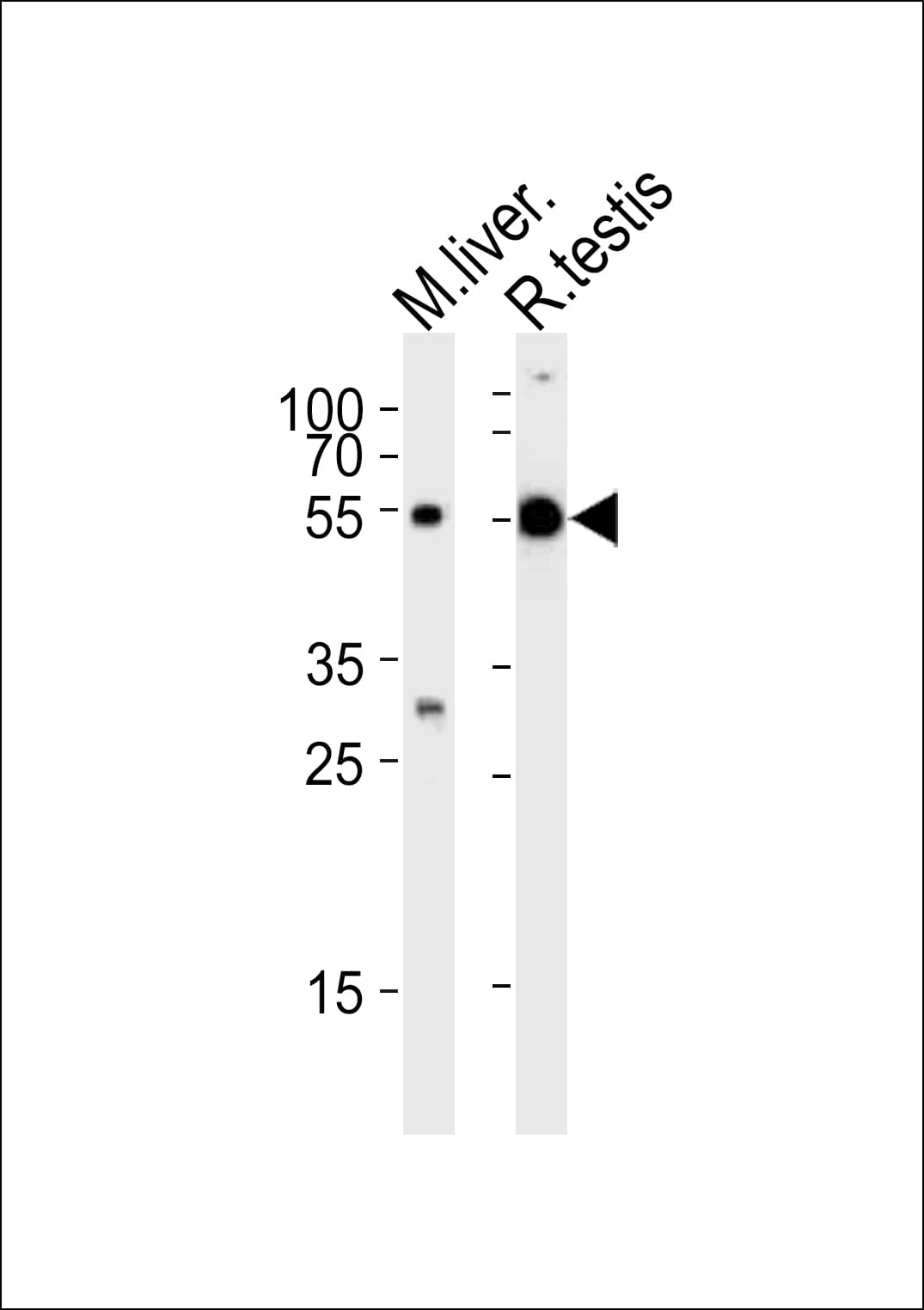 Polyclonal Rabbit anti-Human TUBA1C / Tubulin Alpha 1C Antibody (aa414-441, IHC, WB)