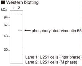 Monoclonal Mouse anti-Mouse Vimentin Antibody (clone 4A4, phospho-Ser55, WB)