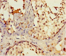 Polyclonal Rabbit anti-Human IFT80 Antibody