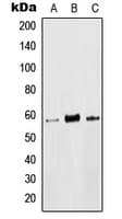 p56lck / LCK Antibody (phospho-Tyr393)