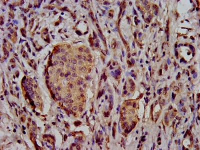 Polyclonal Rabbit anti-Human SCN11A / Nav1.9 Antibody (IHC, IF)