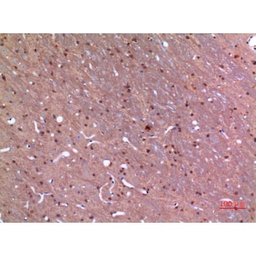 GDI2 Antibody (C-terminal)
