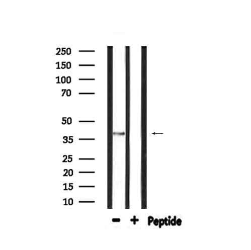 Polyclonal Rabbit anti-Human GDF15 Antibody (IF, WB)