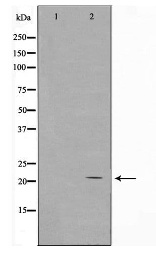 Polyclonal Rabbit anti-Human Histone H1 Antibody (IF, WB)