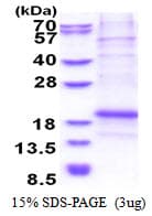 Human LECT1 / Chondromodulin-I Protein (Recombinant His)
