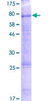 Human URAT1 / SLC22A12 Protein (Recombinant GST)