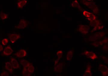 Polyclonal Rabbit anti-Human ACSS1 Antibody (IHC, IF, WB)