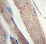 Polyclonal Rabbit anti-Human PIK3C3 / VPS34 Antibody (Ser851, IHC, WB)