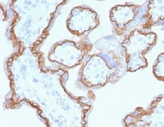 CDH1 / E Cadherin Antibody (clone CDH1/1525)