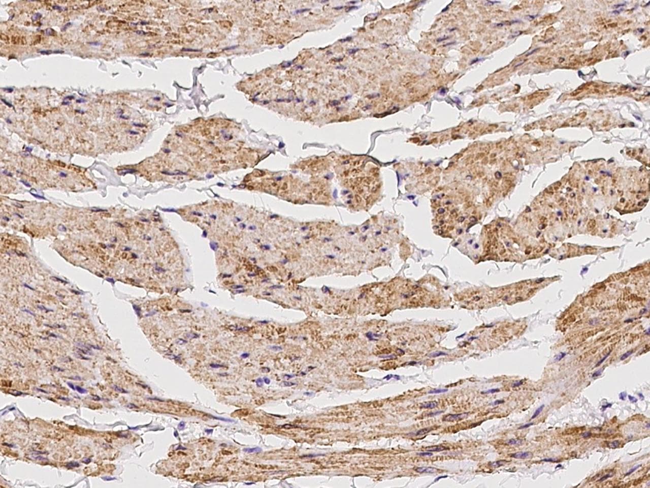 RAB39 / RAB39A Antibody
