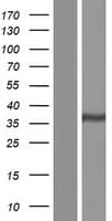 GATSL1 Protein (Over-Expression Lysate Myc-DDK (Flag))