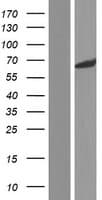 CERKL Protein (Over-Expression Lysate Myc-DDK (Flag))