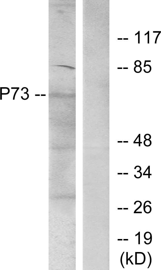 TP73 / p73 Antibody (aa66-115)
