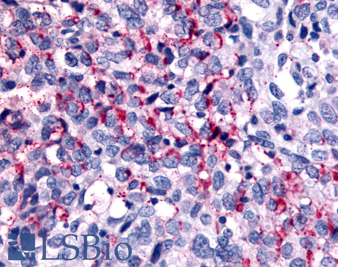 PathPlus™ Polyclonal Rabbit anti-Human WNK1 Antibody (Internal, IHC)