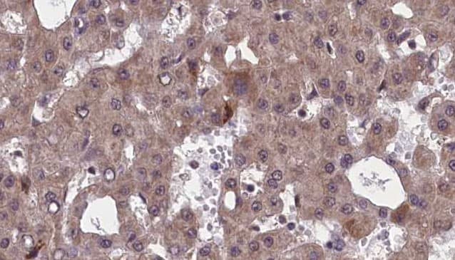 CHRM5 / M5 Antibody