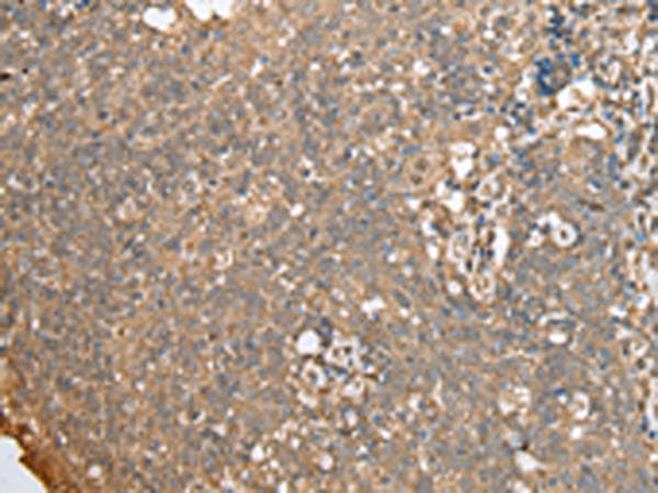 ECI1 / DCI Antibody