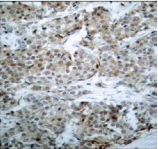 Polyclonal Rabbit anti-Mouse BAD Antibody (IHC, WB)