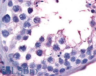 IHC-plus™ Polyclonal Rabbit anti-Human GPR149 / PGR10 Antibody (C-Terminus, IHC)