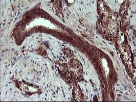 Placental Lactogen Antibody (clone OTI2G4)