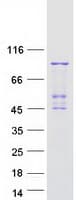 Human PLA2G6 / IPLA2 Protein (Recombinant Myc-DDK (Flag))