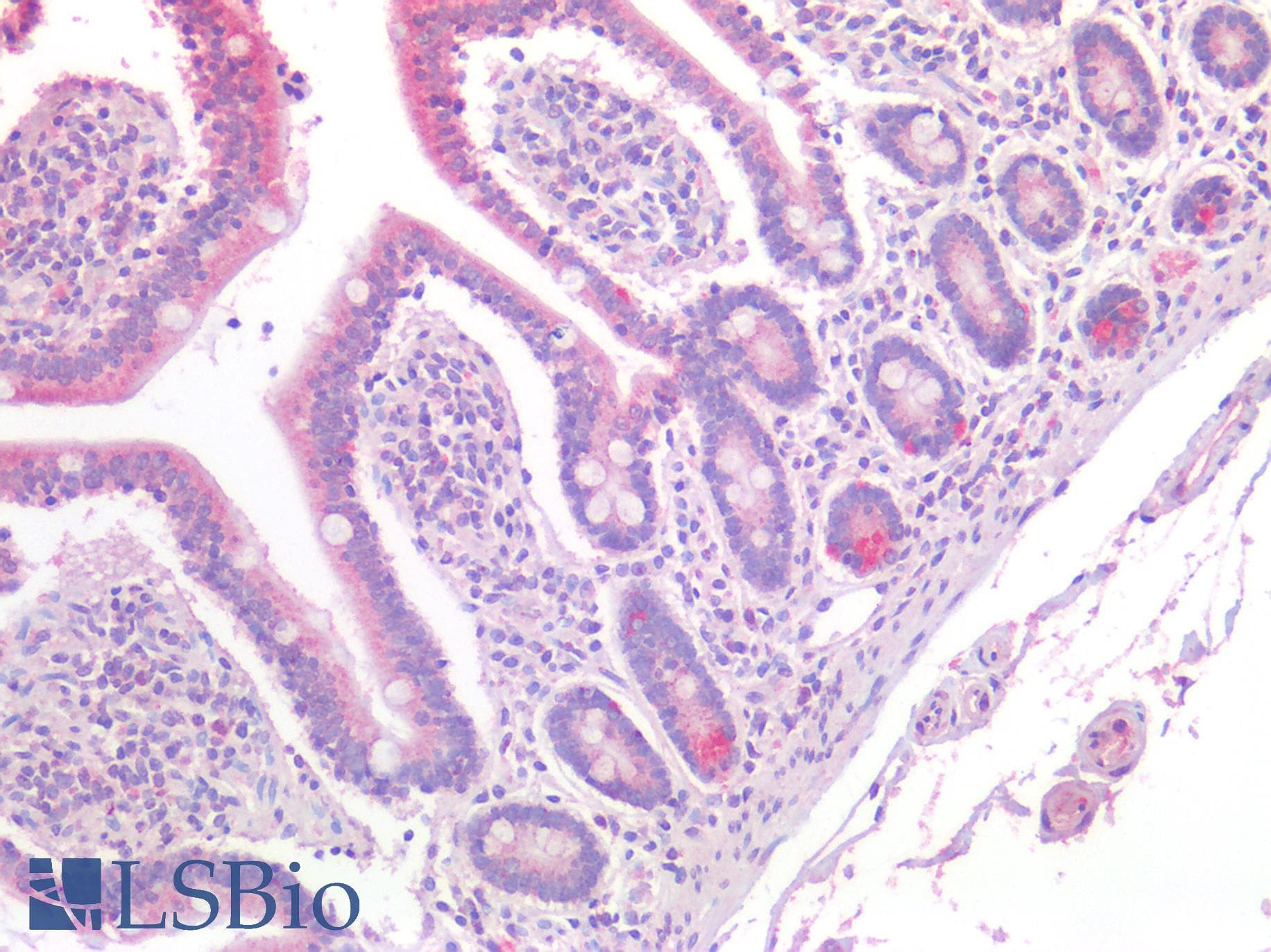 IHC-plus™ Polyclonal Goat anti-Human CAT / Catalase Antibody (IHC, WB)