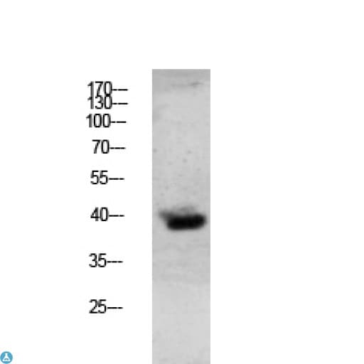 GZMB / Granzyme B Antibody