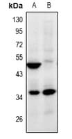ZNF771 Antibody