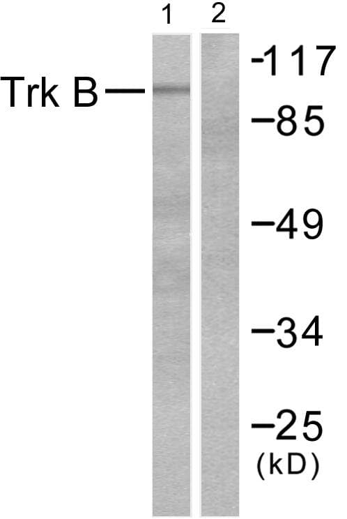 Polyclonal Rabbit anti-Human NTRK2 / TRKB Antibody (p515, IHC, WB)