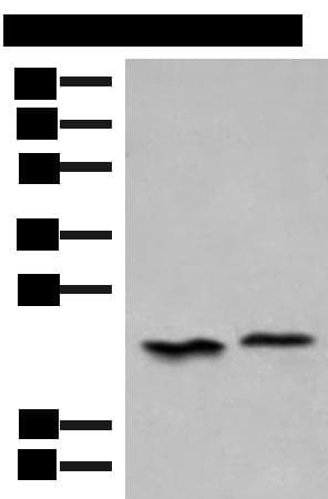 Polyclonal Rabbit anti-Human HEBP1 Antibody (IHC, WB)