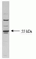 TGFBR1 / ALK5 Antibody (clone 234R32)